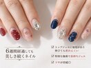 パーツも取れないトップジェル