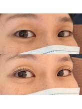 プライベイトスペース コト(PRIVATE SPACE COTO)/ダブルアイリフト