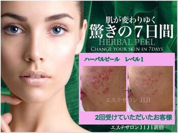 エステサロン ジジ 新宿(JIJI)