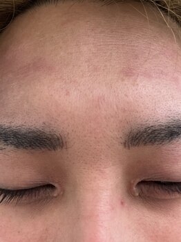 リコリス(Lycoris)/毛穴洗浄