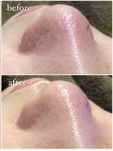 ベベ 金沢片町店(Be’be’)/その場で実感！ビフォーアフター