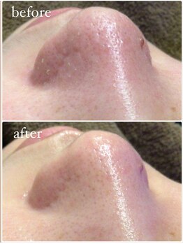 ベベ 金沢片町店(Be’be’)/その場で実感！ビフォーアフター