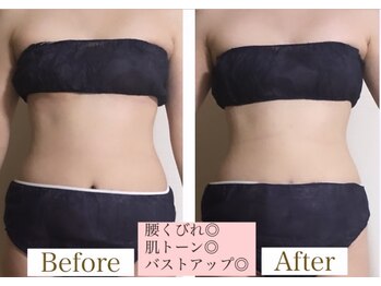 ヨサパーク シュエット(YOSA PARK CHOUETTE)/くびれが欲しいっっ！