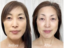 ドクターボディ 新宿店(Dr.Body)/【面長/左右差/顎の歪み 50代】