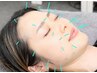 人気NO2【癒しの美容鍼】しわ/たるみ/くすみ/むくみ改善に◎　60分 7,800円→
