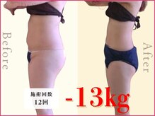 痩身エステ 美容整体 ドクタースタイル(Dr.Style)/最新痩身マシン&リンパ/岐阜