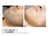 【メンズ】新生活応援♪美肌になるヒゲ脱毛2回セット 9,980円