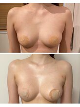 ルナグランデ 心斎橋店(Luna grande.)/最新豊胸エステ