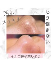 ビューティーツリー(Beauty Tree)/毛穴ケアも得意