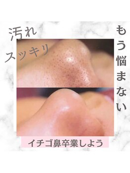 ビューティーツリー(Beauty Tree)/毛穴ケアも得意