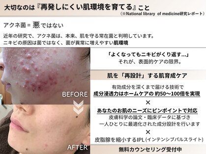 ビアンカの写真