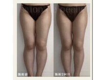 サロンドペシェ(salon de peche)/20代＊痩身コース2回目