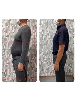 サンライズ鍼灸整骨院 淀屋橋院/耳ツボダイエット