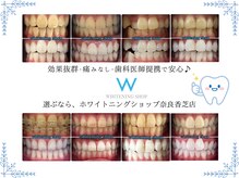 ホワイトニングショップ 奈良香芝店(Whitening shop)