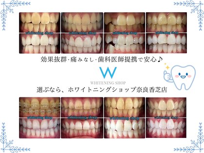 ホワイトニングショップ 奈良香芝店(Whitening shop)の写真