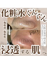 ミュウ(miuex)/肌質改善