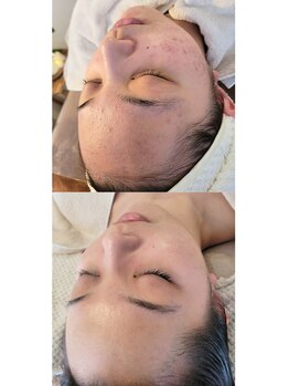 ムーフ(Moof)/土台から強く美しく