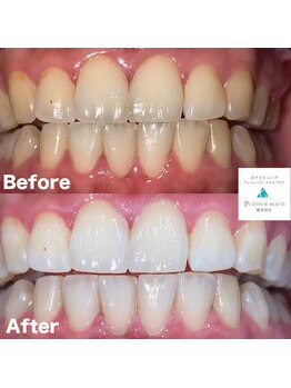 プラチナムビューティー 横須賀店/