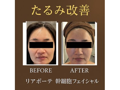 ザ アールアール(THE RR)の写真