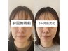 【結果重視◎】毛穴レス×たるみ根本改善フェイシャル¥19,800→¥9,900