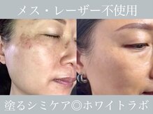 グラシアスの雰囲気（日本初上陸のシミケアセラム【ホワイトラボ】導入しました!(^^)!）