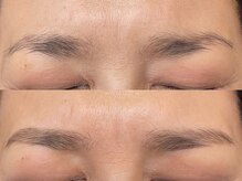 アンベリール(Embellir)/眉毛beforeafter