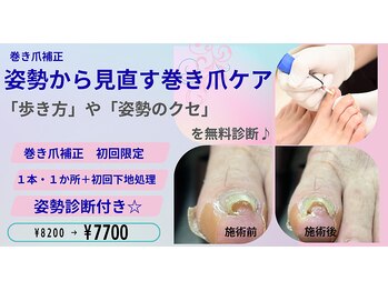 小田急相模原巻き爪矯正センターの写真/巻き爪を丁寧にケア。さらに歩き方・姿勢からサポート