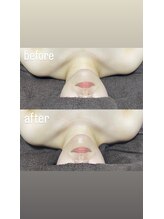 ビューティーサロン アール(R)/リンパマッサージ60min