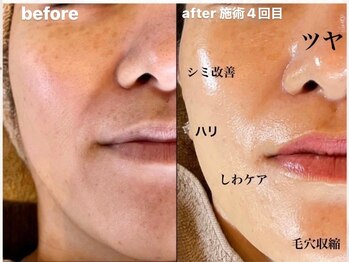 リノアンド(Lino&)/オーダーメイド式　光フォト