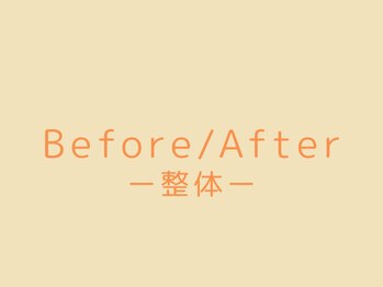 ストラボ 横浜店/整体before/after