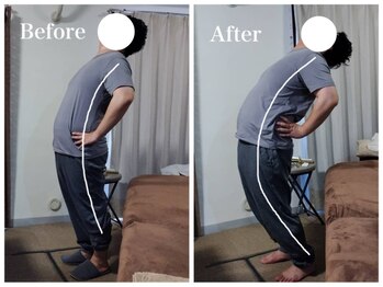 エイル(EIR)/腰痛・肩こり