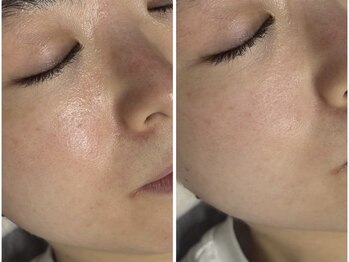 アンリミット 鹿児島天文館店(Une limit)/さらに綺麗に！