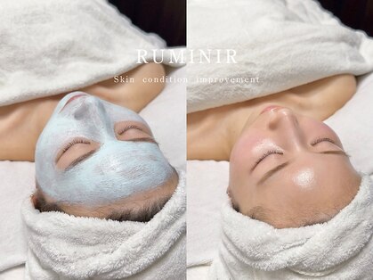 ルミニール(RUMINIR)の写真