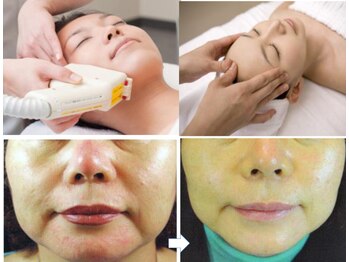 センティア アピタ大口店/生コラーゲン・フォト美顔