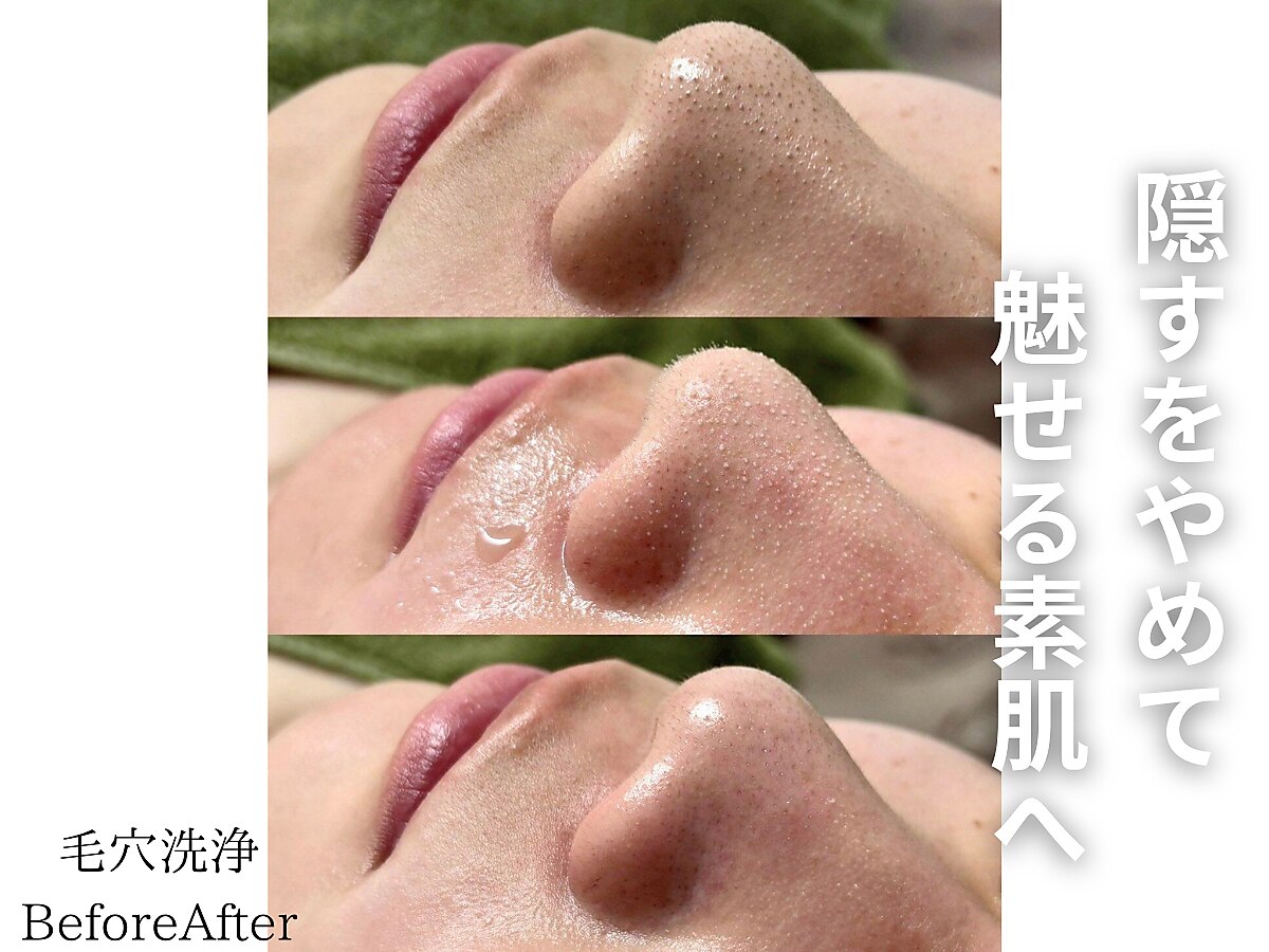 シンディー(CINDY)｜ホットペッパービューティー