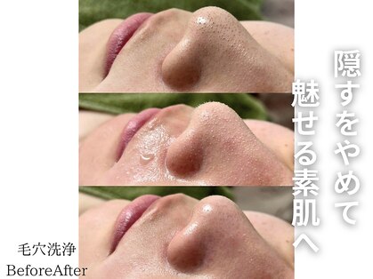 シンディー(CINDY)の写真