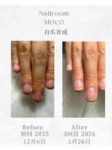モコ(MOCO)/自爪育成