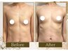 【産後ケア】卒乳後のバストハリ戻し90分+腸もみ15分でポッコリお腹解消