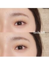 トレス(tress)/ピーナッツロッド