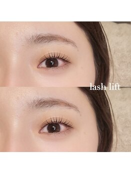 トレス(tress)/ピーナッツロッド