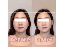 小顔整顔で自然に整えます♪