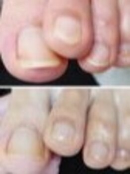 リゼラアンドコー 船橋店/ドイツ式フットケア専門店