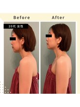 マリエンドリー/頸椎リヴァイブ　オプション