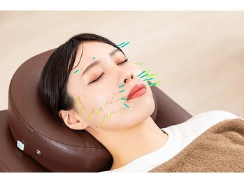 新宮中央整骨院 はりきゅう院/気になるたるみケアに☆美容鍼灸