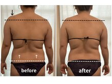 ケイ(K)の雰囲気（左肩に強く出ていた僧帽筋の張り感がとれ、自然な肩のラインに！）