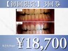 【初回限定】短期集中で白さ実感!お得な3回コース¥23,940→¥18,700