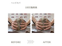 サロンエイトミー 西船橋店(salon 83)/ヘッドスパ/before→after
