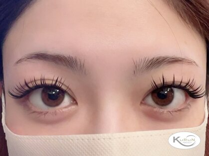 クルン(KURUN)の写真