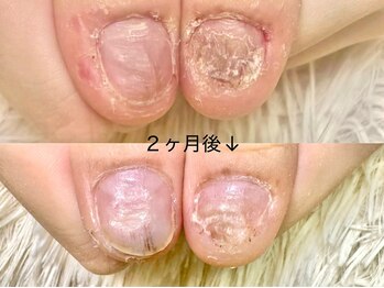 グラシナ 名古屋金山店/(深爪／長さだし/フィルイン)