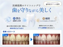 ハイティース 高田馬場店(Hi Teeth!)